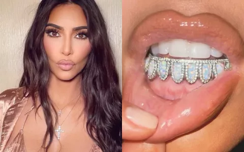 Kim Kardashian adquirió una nueva 'joya dental' valorada aproximadamente en $18,000