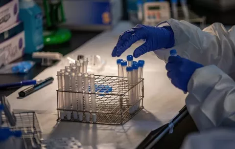 Expertos  desaconsejan  uso de pruebas serológicas para evaluar anticuerpos en vacunados 