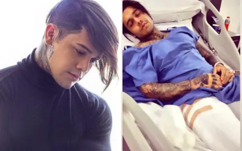 Yeferson Cossio, 'influencer' colombiano, sufrió un accidente que le imposibilitará caminar por cinco meses