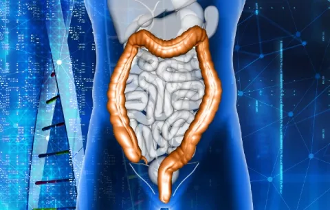Desinformación y machismo: los enemigos del cáncer de colon