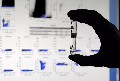 Desarrollan un nuevo test que logra detectar anticuerpos contra la covid-19 hasta hoy invisibles