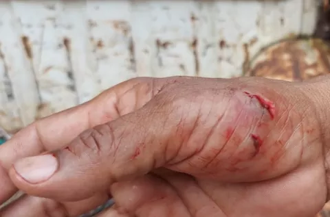 Lagarto ataca a funcionario de MiAmbiente cuando era rescatado en Cristóbal, Colón