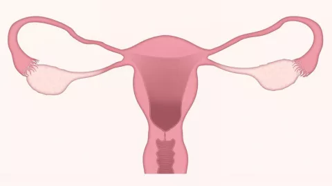 Cáncer de ovario y su impacto en la fertilidad