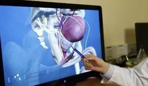 Cáncer de próstata: ¿Cómo entender la enfermedad? 