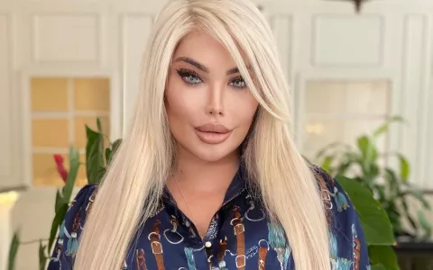 Critican al 'Ken humano', ahora convertido en 'Barbie, por sus nuevas cirugías