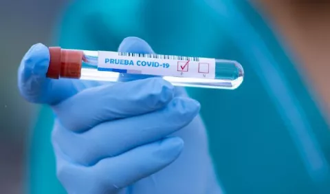 Aprendizajes y retos que deja la 'pandemia de la covid-19'