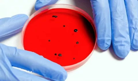 Superbacterias: ¿Cómo protegerse?