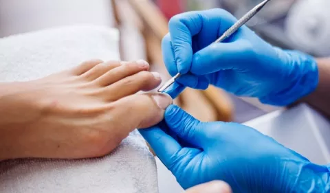 'Tips' para prevenir los hongos en las uñas