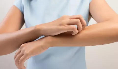 Dermatitis atópica y sus desafíos en tiempo de la covid-19