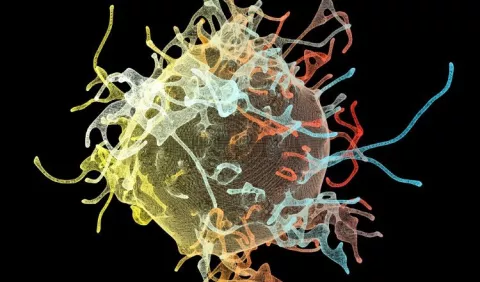 Meningitis: Conoce cómo afecta al organismo
