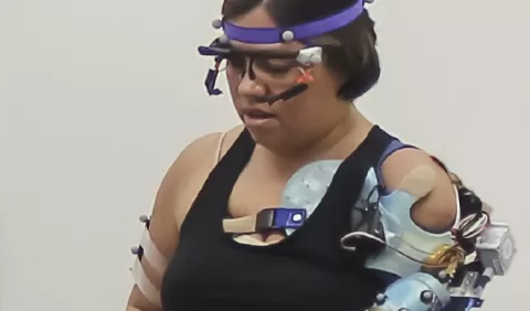 Investigadores estadounidenses desarrollan un brazo biónico