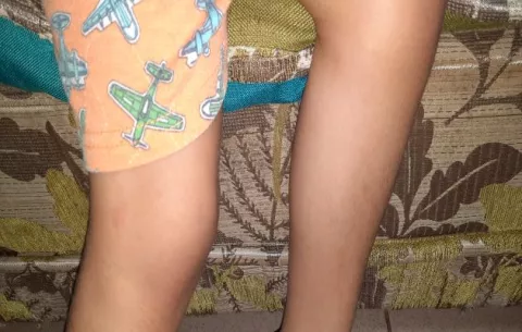 Abuelo abusaba de su nieta de dos años y la infectó con el VIH