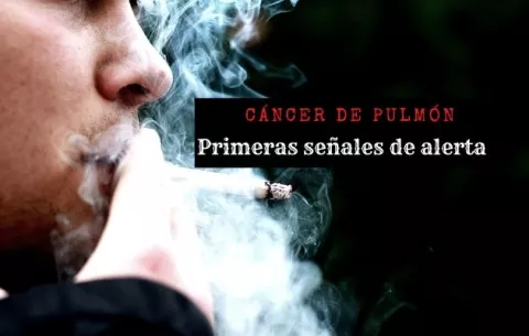 Cáncer de pulmón: 10 aspectos que debes tener en cuenta