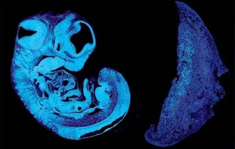 Los genes paternos y maternos intentan controlar los nutrientes en el útero