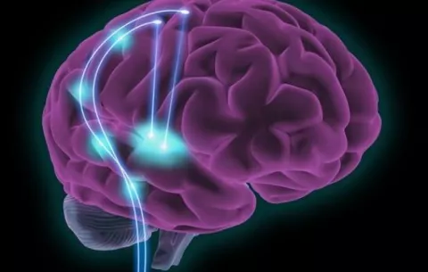 Desarrollan sondas neuronales de grafeno que detectan señales epilépticas