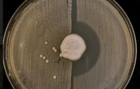  Resistencia de bacterias a la meticilina surgió de modo natural hace 200 años