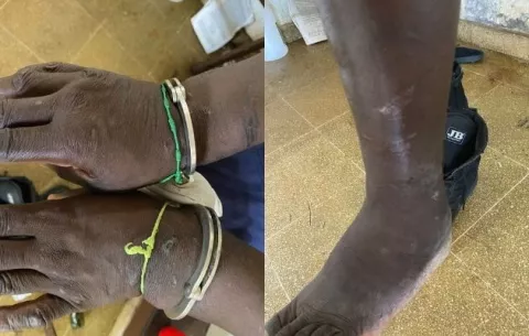 Defensoría del Pueblo advierte trato infrahumano a reo con trastornos psiquiátricos en La Joyita