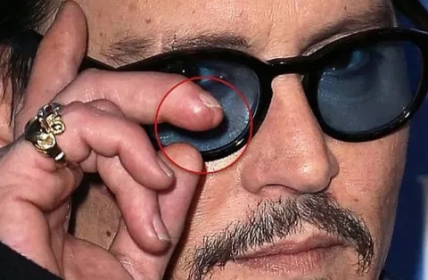 Johnny Depp perdió parte de un dedo durante una pelea con Amber Heard: ¿Cómo sucedió?
