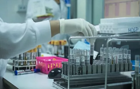 Técnicos asistentes de laboratorio clínico de la CSS inician paro