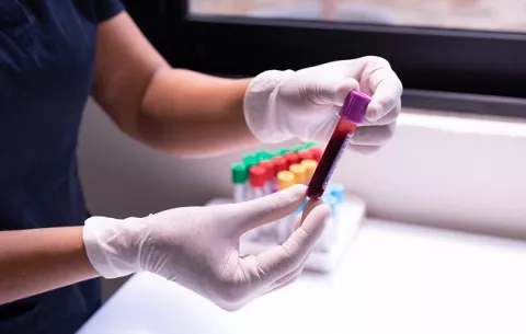 ¿Cuál es el 'colesterol malo' y por qué es importante conocerlo?