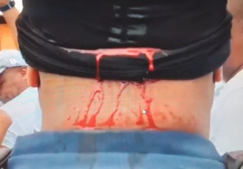 En el segundo día de protestas en Colón, disparan contra un policía y otro es golpeado en la cabeza 