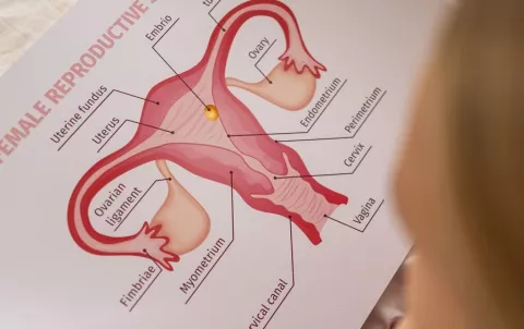 Salud femenina: ¿Qué deben saber de la microbiota vaginal? 