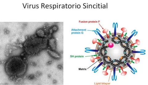 El virus sincitial causó 100,000 muertes en niños menores de 5 años en 2019 