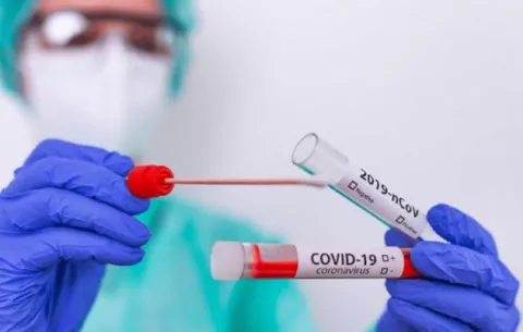Panamá suma 826 casos nuevos de covid-19 y un fallecimiento este lunes