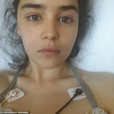 Emilia Clarke fue operada en dos ocasiones mientras rodaba 'Game of Thrones'