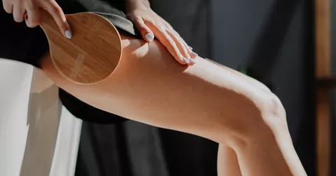 Venas varicosas: ¿Pueden causar dolor en las piernas? 