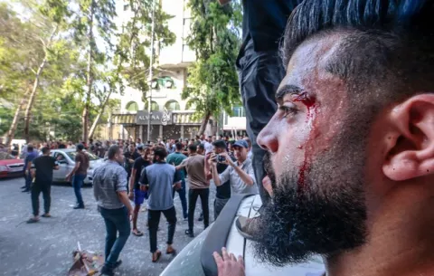 'Ataque preventivo' de israelí sobre la Franja de Gaza amenaza con una importante escalada de violencia