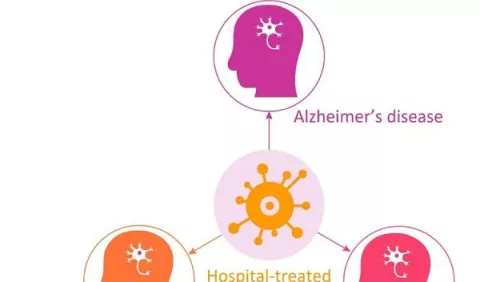 Infecciones hospitalarias elevan riesgo de Alzheimer 