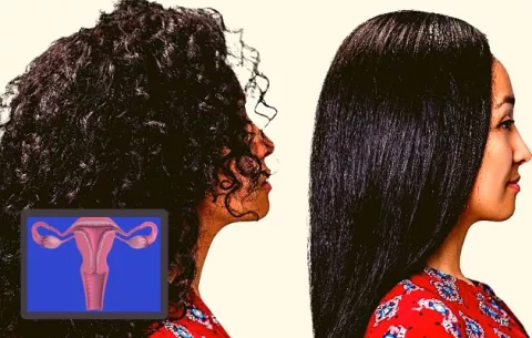 Belleza versus salud; alisantes de cabello aumentan el riesgo de cáncer de útero