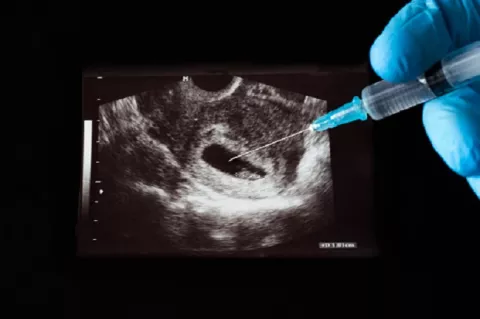Estudio revela oposición que existe por la eutanasia, aborto y el matrimonio entre personas del mismo sexo