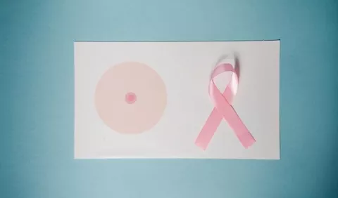 Impacto de la reconstrucción mamaria en las sobrevivientes de cáncer