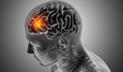  El cerebro de los 'superancianos' tiene 'superneuronas'