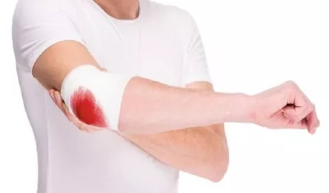 ¿Cómo mejorar la calidad de vida de un paciente con hemofilia?