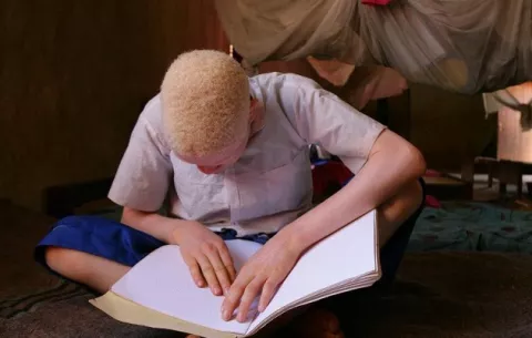 Ola de secuestros de albinos sacude Madagascar