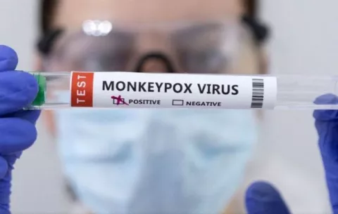 Minsa reporta tres nuevos casos de viruela del mono