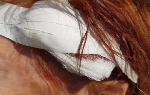 Atacan a una adulta mayor por acabar con una fiesta en una playa de San Carlos 