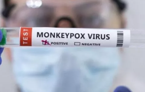Panamá acumula 99 casos de la viruela del mono