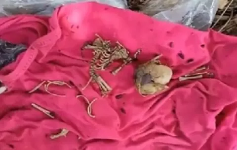 Hallan restos óseos de infante en escuela Victoria D' Spinay