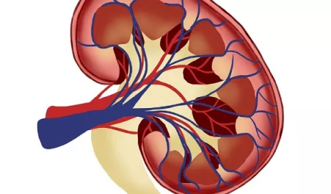 Barreras que afectan la salud de los riñones