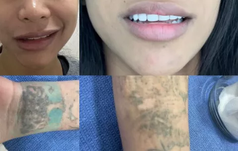 Clínica estética ilegal; dos pacientes denuncian secuelas