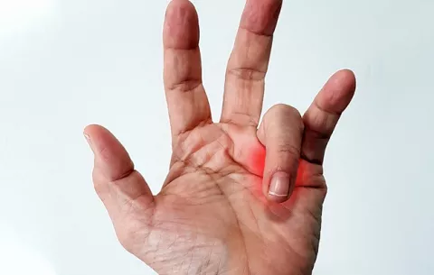 ¿Por qué se atascan los dedos, quedando doblados o rectos?
