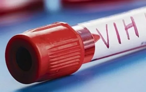 Nueva terapia para tratar el VIH llega a Panamá