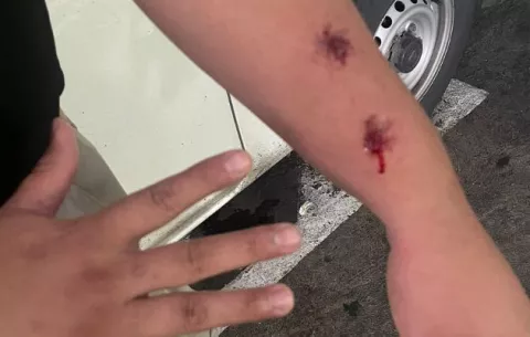 Extranjero muerde en el brazo a un inspector de Migración 