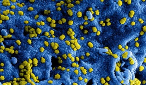 Resistencia a los antimicrobianos: ¿Cómo combatirla?