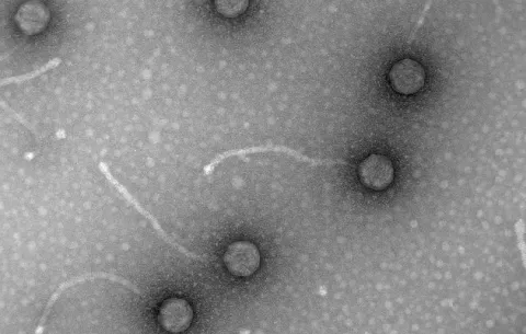 Virus ayudarían a combatir resistencia a los antibióticos 