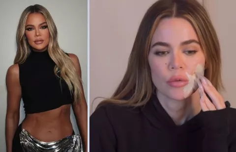 Khloé Kardashian, el antes y después de su cáncer de piel